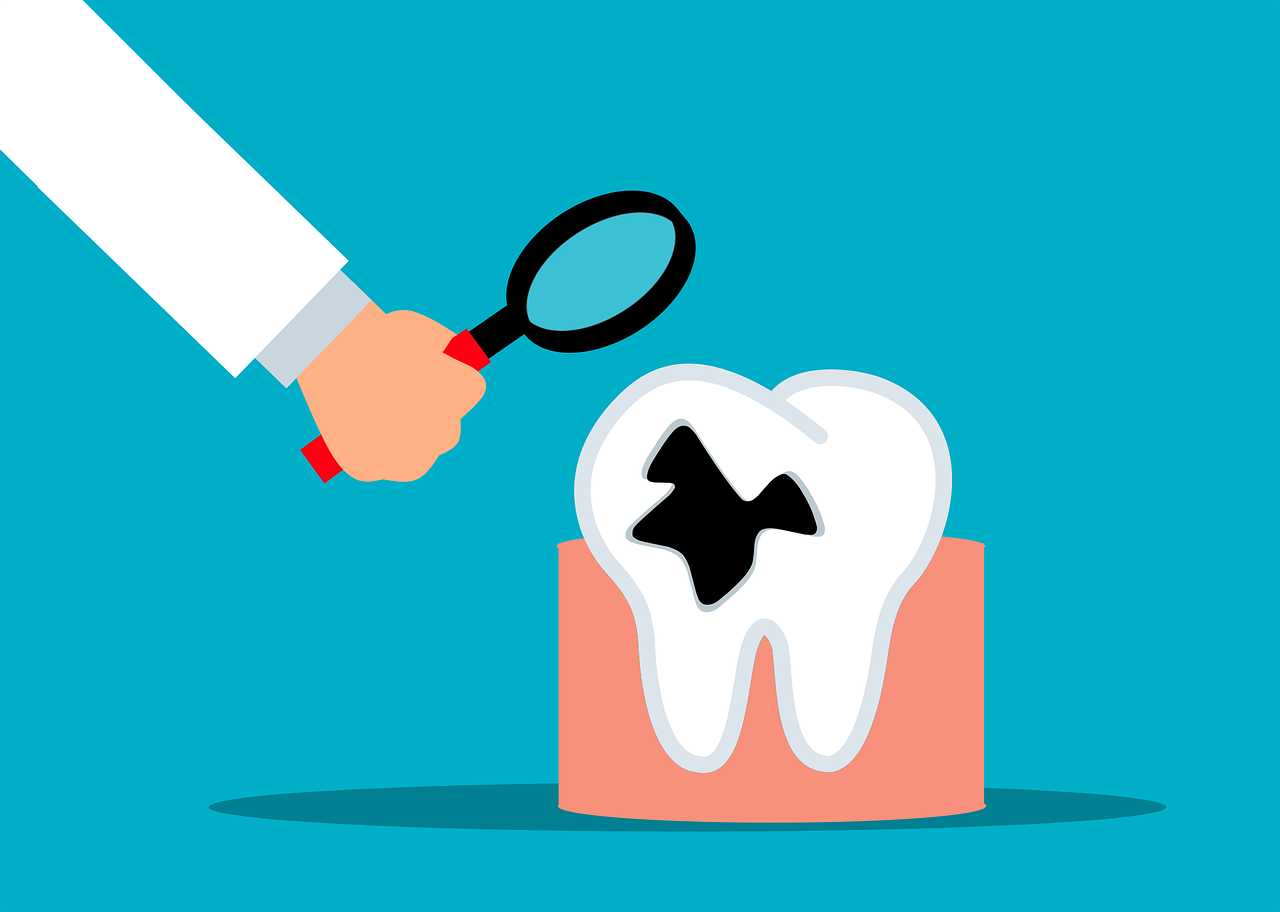 Dentist inspecting a cracked tooth with a magnifying glass